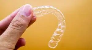 Clear retainer cost comparison Invisalign