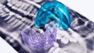 How to Clean a Mouth Guard?
