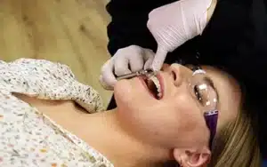 orthodontic problems